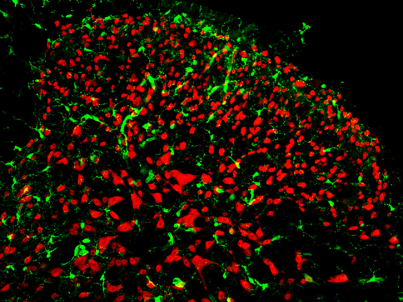Thumbnail of Spinal microglia and neurons