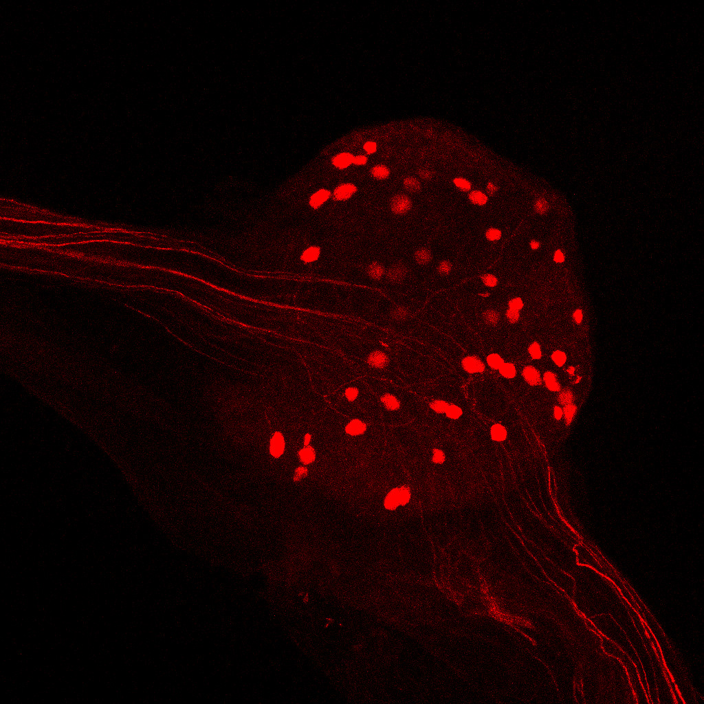 Thumbnail of Colon-innervating D R G neurons